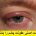 علائم اصلی عفونت چشم