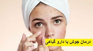 درمان جوش های پوست با دارو گیاهی
