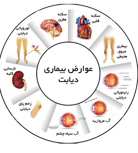 پیشگیری از دیابت نوع ۲ با پیاده روی 