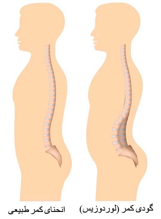 تشخیص
