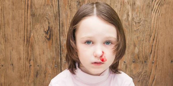 chronic nosebleeds in children